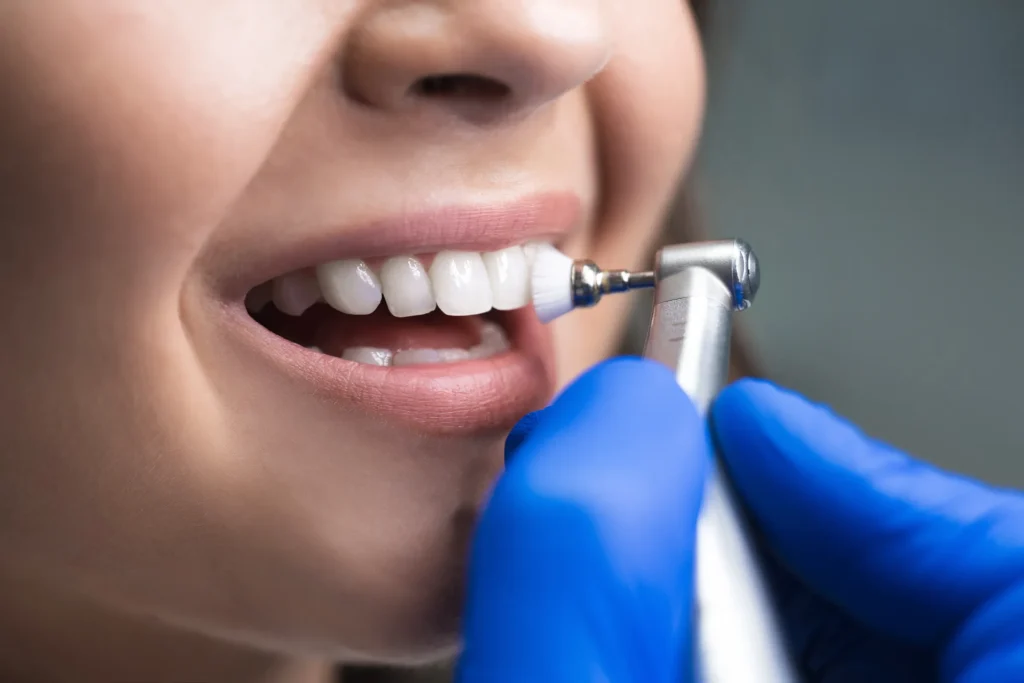 Dental hygienist polishing a patient's front teeth with a handpiece