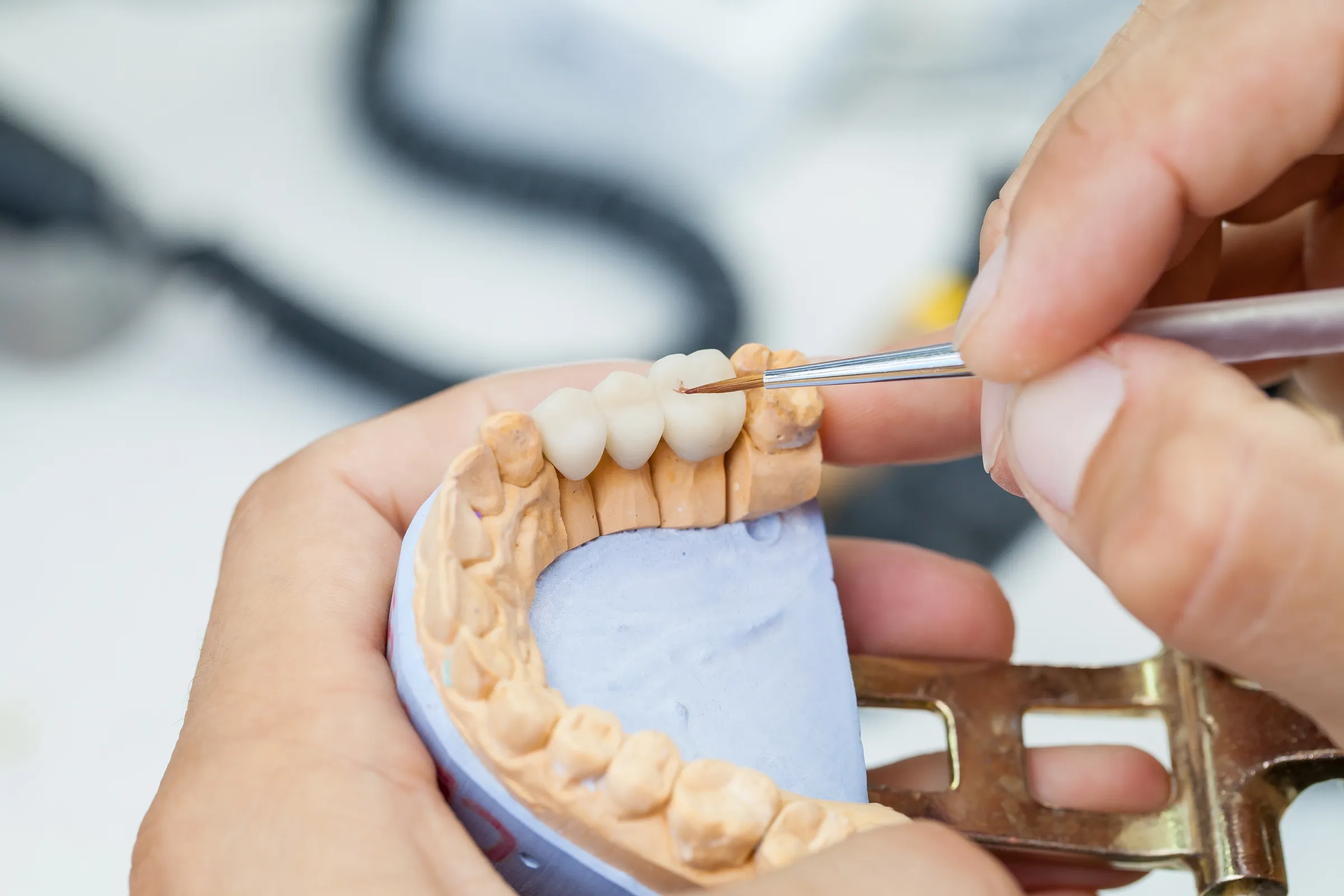 Technician adjusting a dental bridge on a plaster model