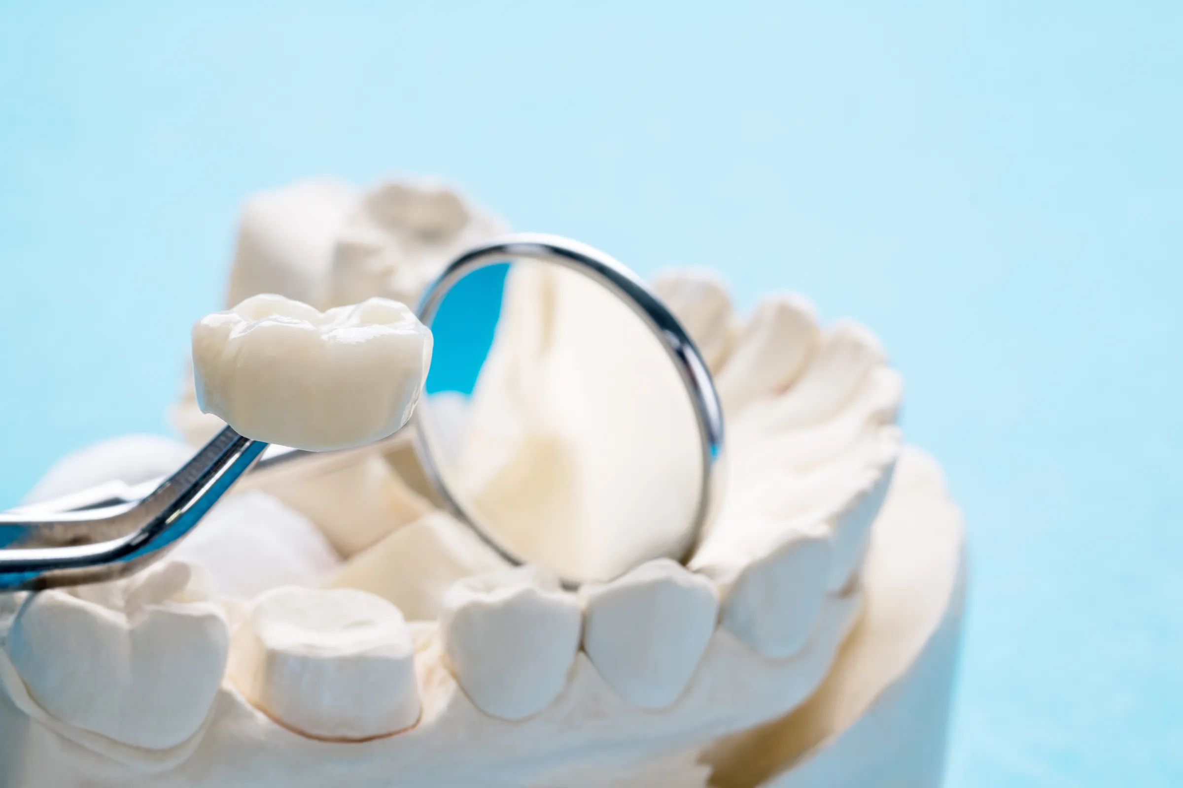 Dental crown on a model beside a dental mirror