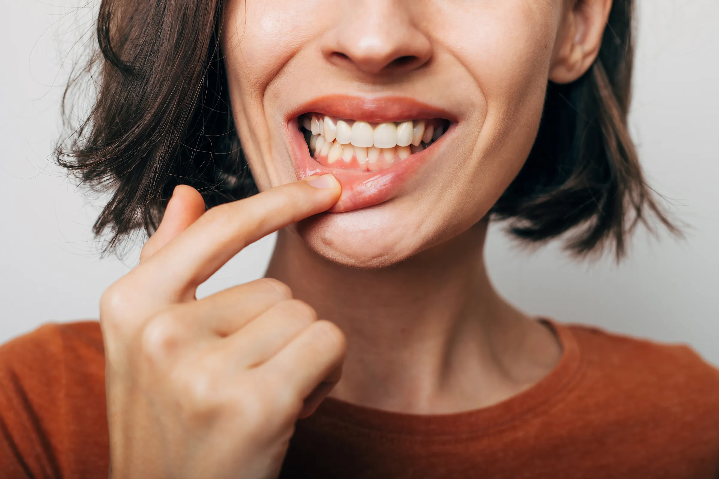 Woman pulling her lip down to show inflamed gums