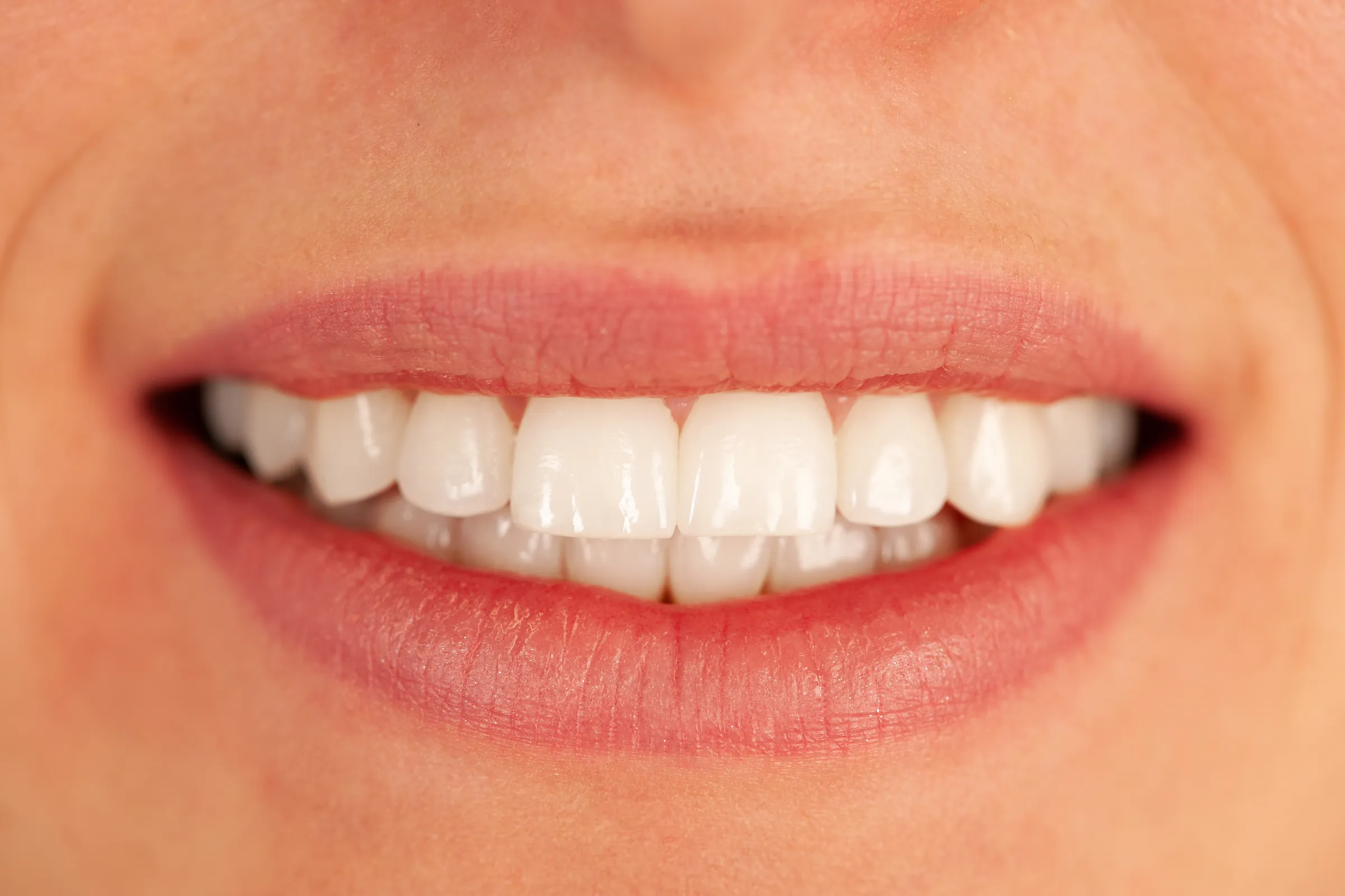Close-up of a smile with uneven tooth edges