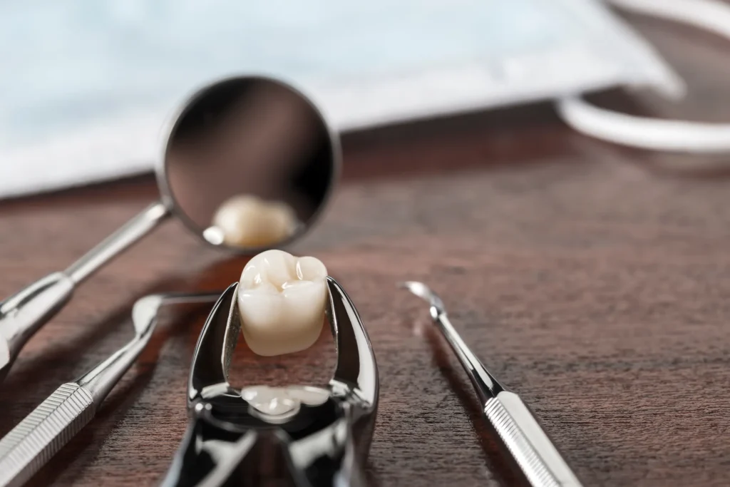 Extraction forceps holding a tooth beside dental instruments
