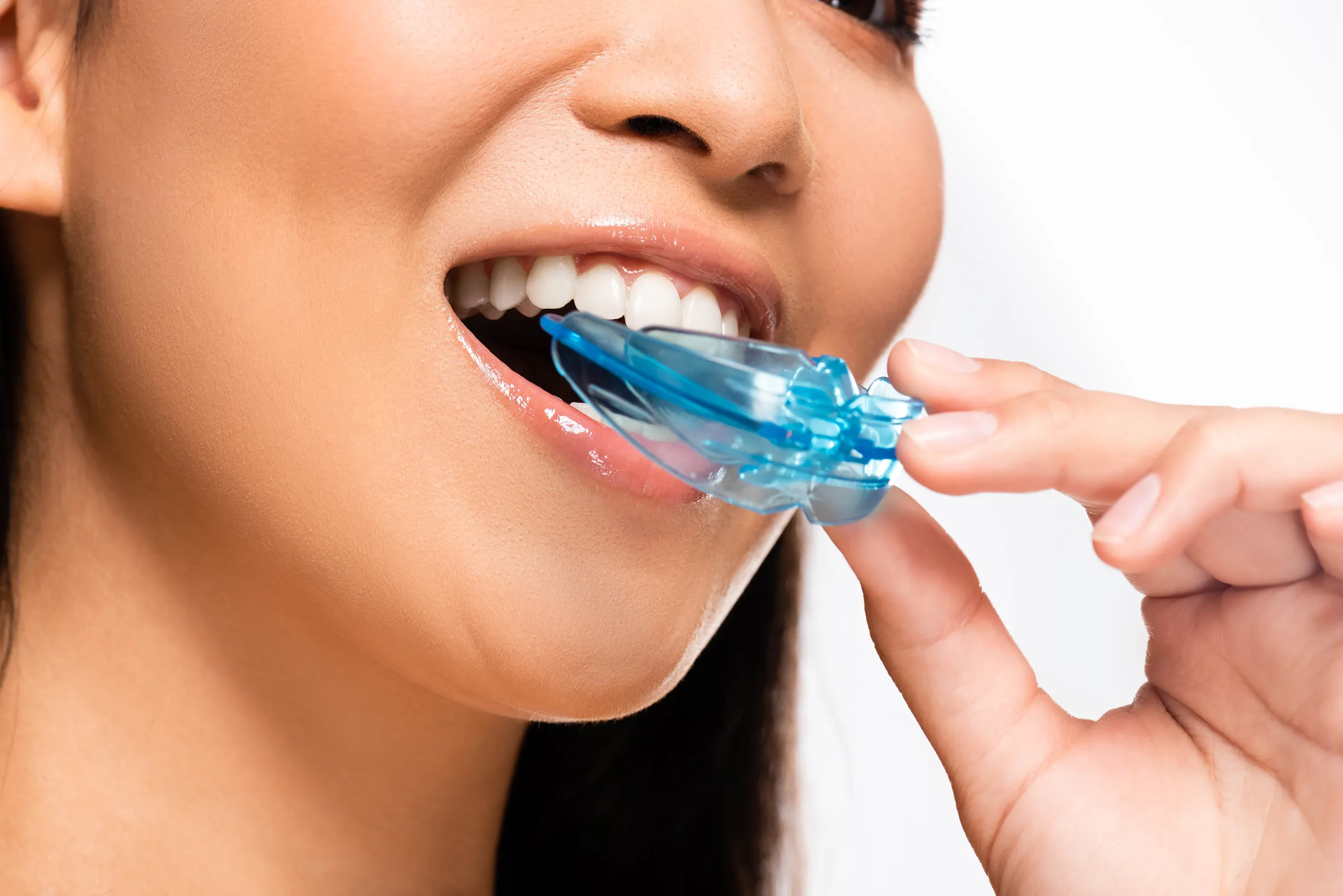Custom-fitted sports mouth guard