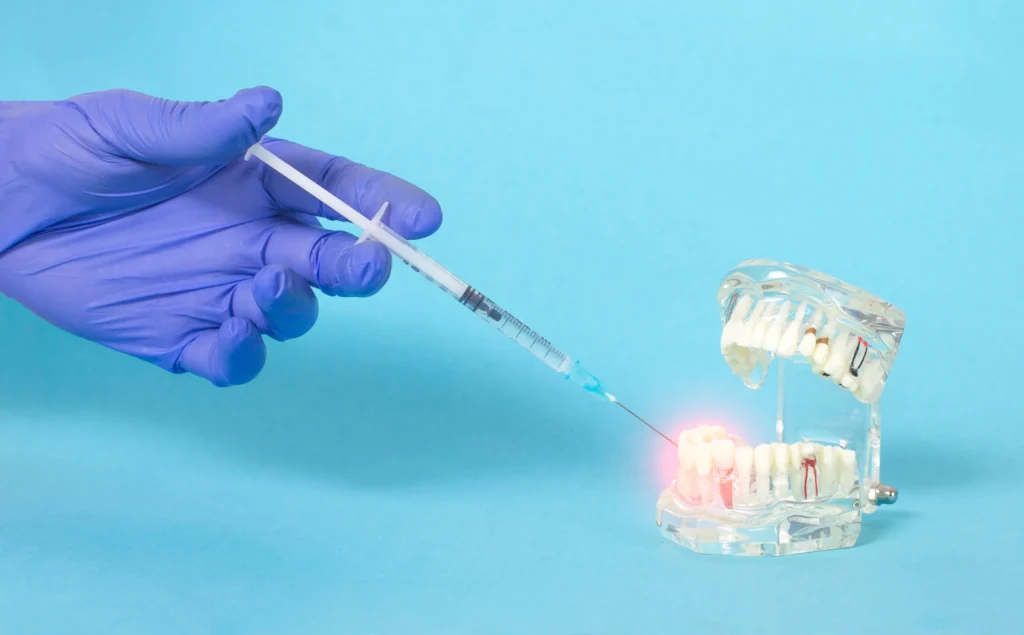 Ozone therapy being applied to a dental model