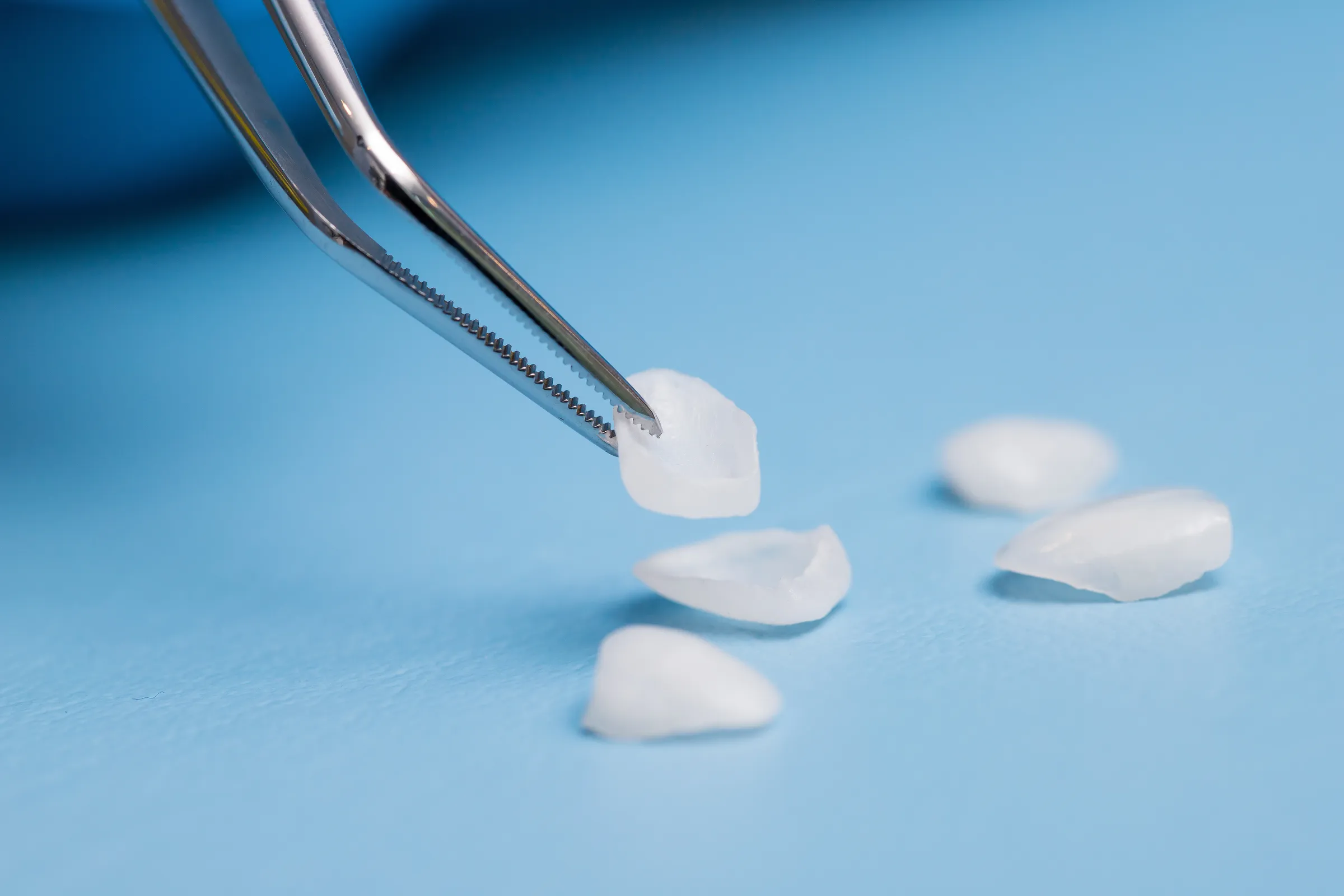 Tweezers holding a porcelain veneer