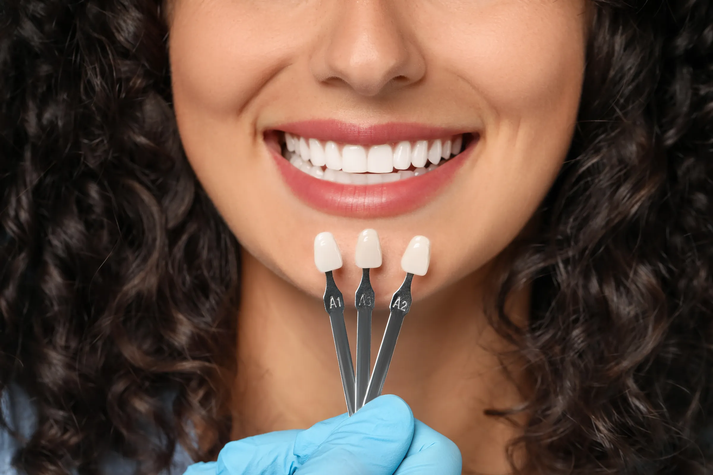 Woman having veneer shades matched